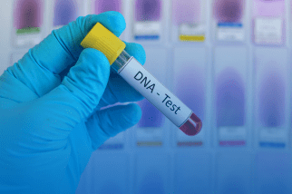 Tubo de ensaio para teste de DNA indicando serviço de investigação de paternidade em Itapetininga